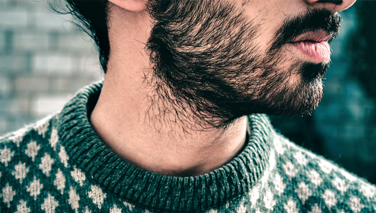 Grow a Thicker, More Uniform Beard: Discover the Reasons Behind Patchy Facial Hair and Practical Tips to Achieve Your Dream Beard