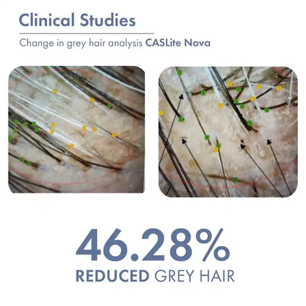 Thrive Anti-Grey Hair Prime Serum - Reverse grey hair starting 8 weeks, 50ml